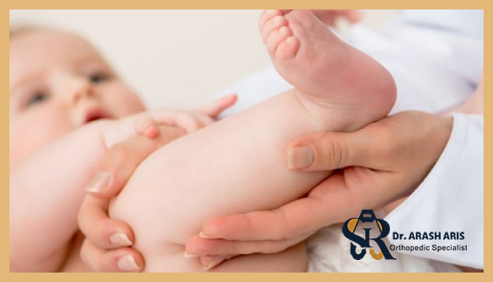 علائم دررفتگی مادرزادی لگن