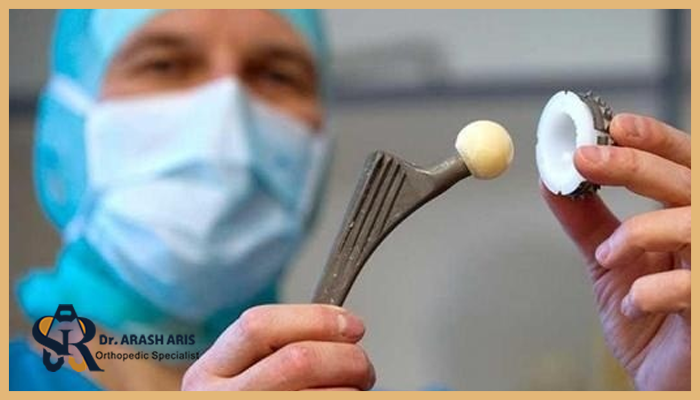 اقداماتی که باید قبل از تعویض مفصل لگن انجام دهید!
