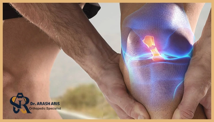 تفاوت علائم پارگی رباط صلیبی قدامی و خلفی
